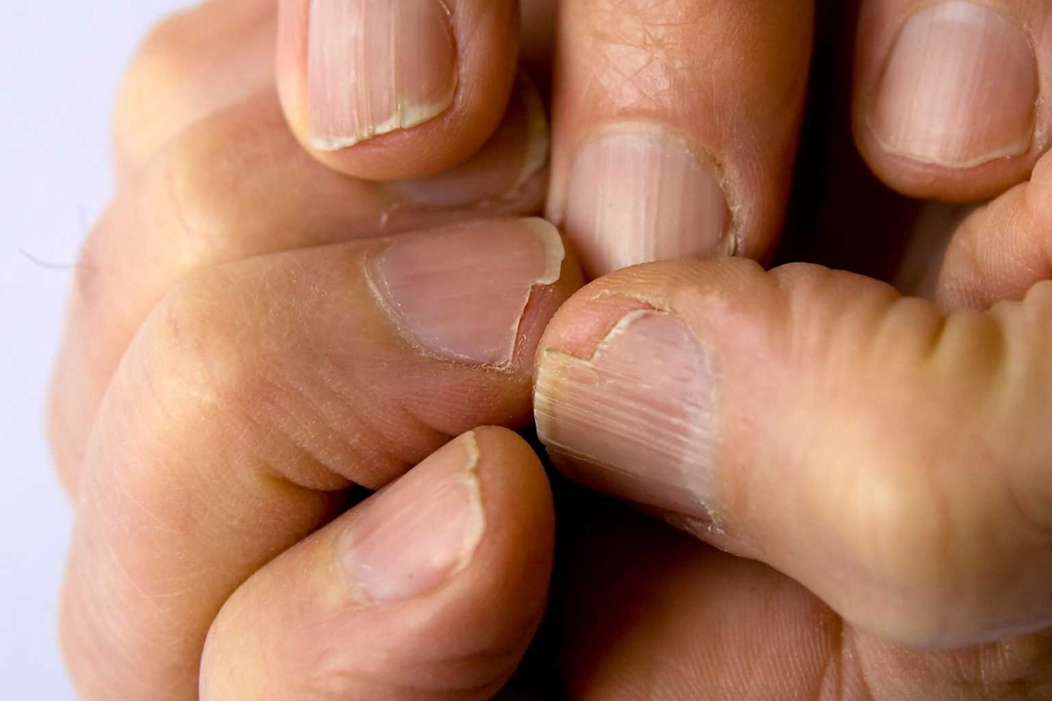 Болезни ногтей: как определить заболевание